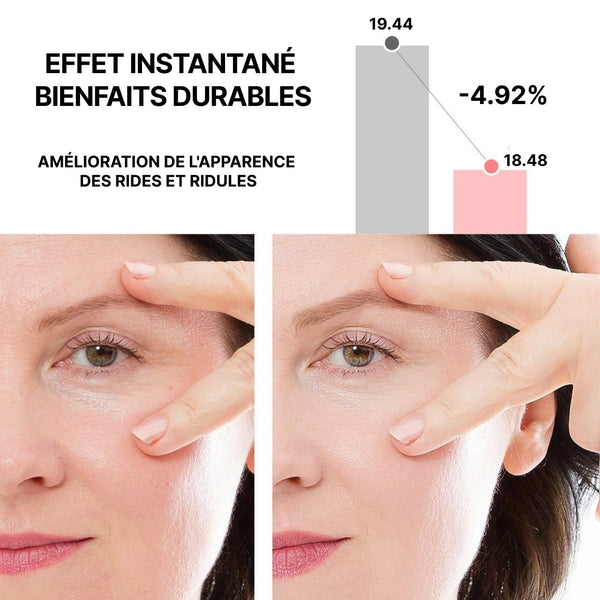 Crème Au Rétinol Pour Les Yeux